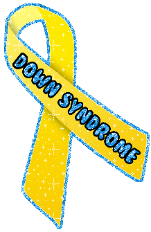 Down Syndrome picture